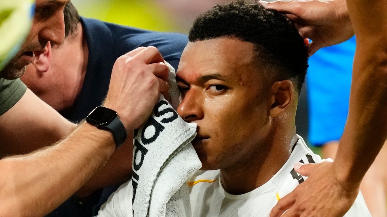 Mbappé sanguinante in area durante Real-Girona, furia Arbeloa: "Quando non vogliono chiudono un occhio"