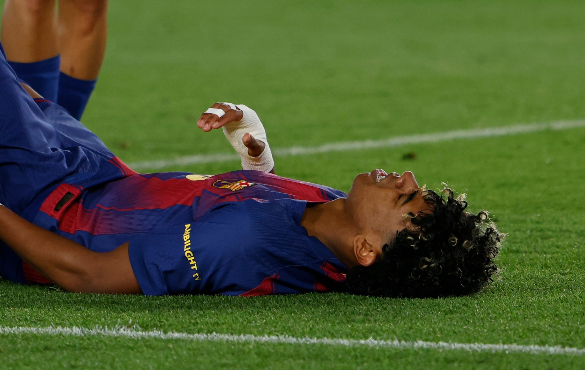 Lamine Yamal, la diagnosi ufficiale del Barcellona sull'infortunio: forse ce la fa per i Mondiali