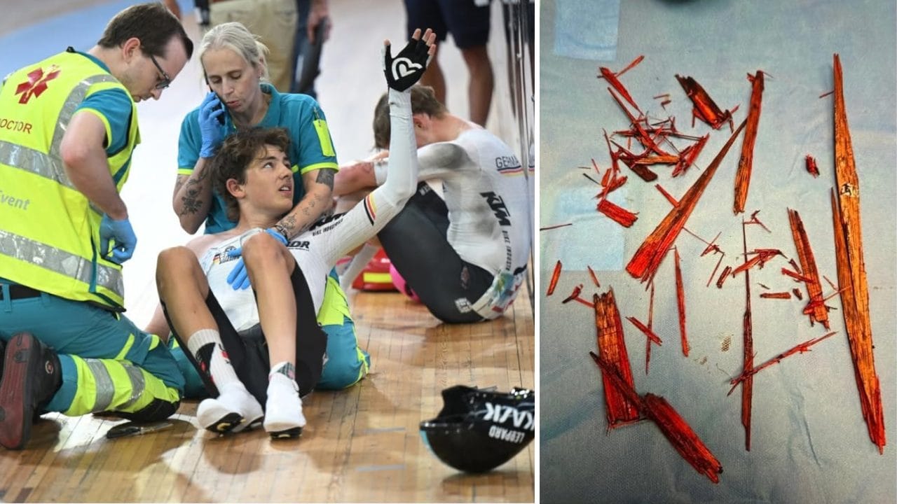 Moritz Mauss racconta l'incidente in pista a Gand: "Una scheggia di 50cm mi ha penetrato anca e gamba"