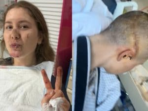 La 19enne Kamilla Aasebo operata alla testa dopo l’ultima Roubaix: mostra l’impressionante cicatrice