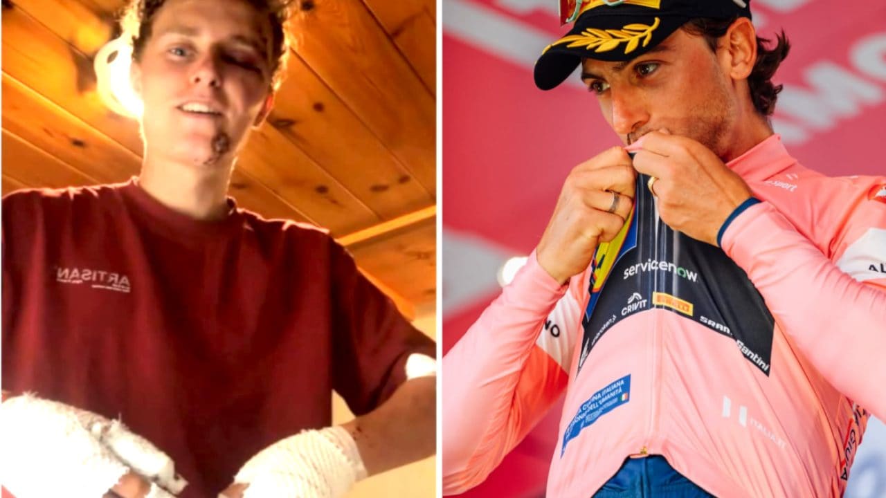 Albert Philipsen mostra le conseguenze del suo terribile incidente nel giorno della Maglia Rosa di Ciccone
