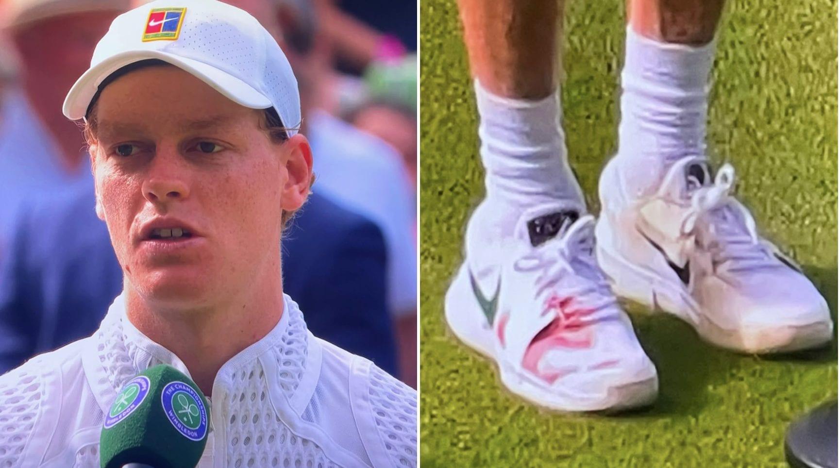 Sinner finisce insanguinato la battaglia con Kecmanovic a Wimbledon: “Sembra molto peggio di quel che è”
