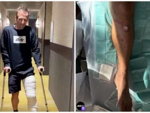 Zarco mostra le condizioni della sua gamba: “Non mi sono operato perché è bruciata in profondità”