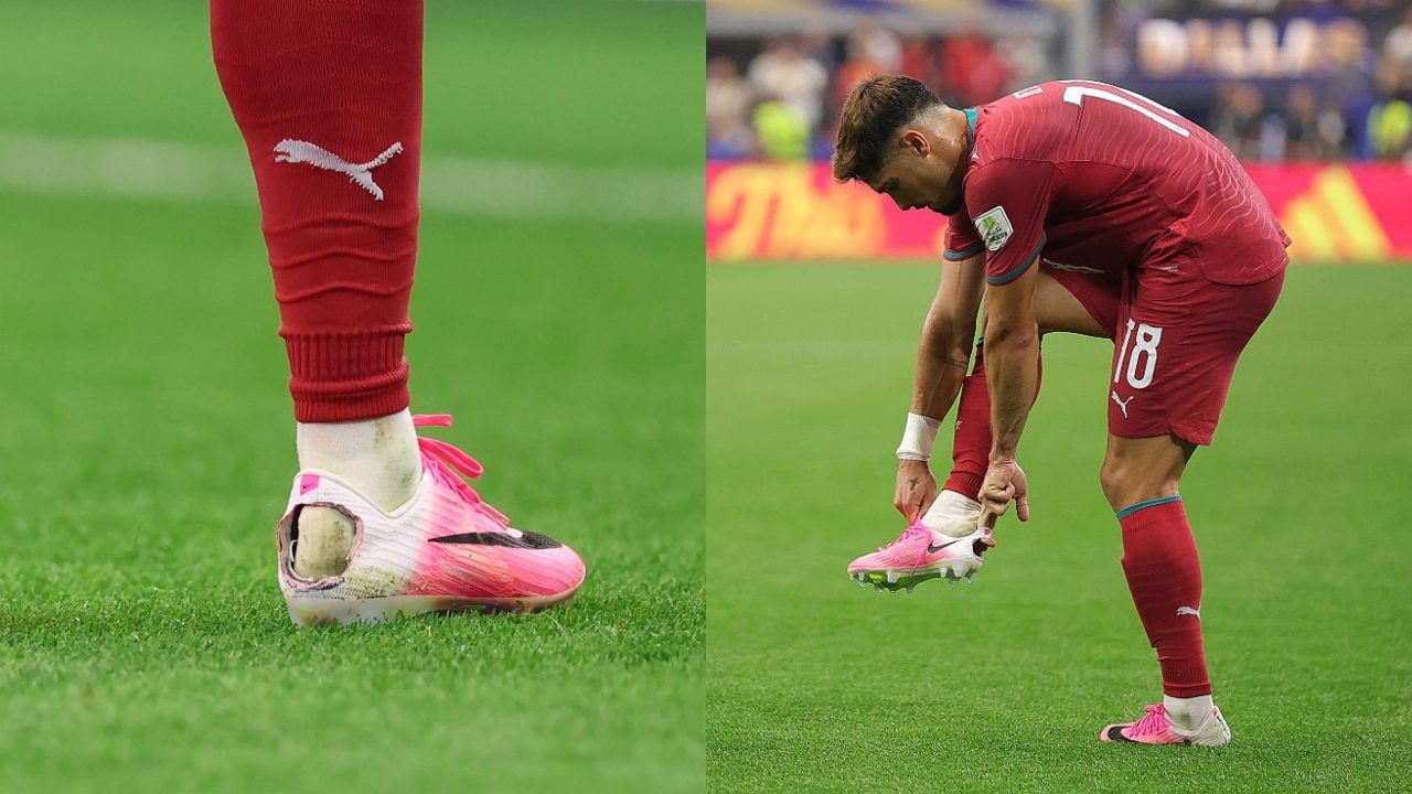 Pedro Neto e lo scarpino bucato dietro il tallone ai Mondiali: cos'è la sindrome di Haglund