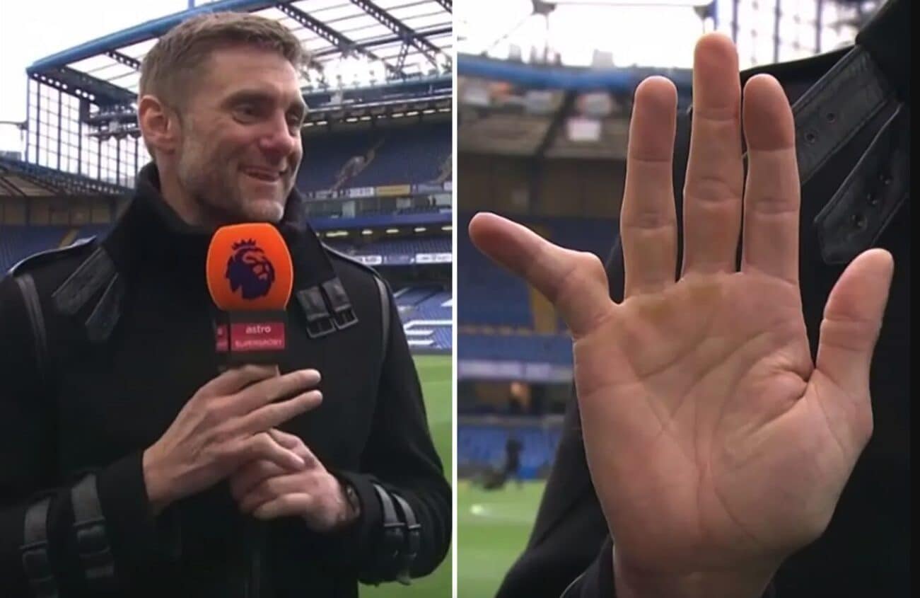 Rob Green, ex portiere del Chelsea, ha il mignolo della mano destra a "martello".