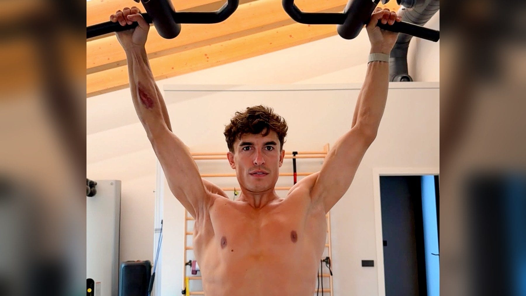 Marc Marquez mostra per la prima volta il braccio destro operato sette volte: ha cambiato forma