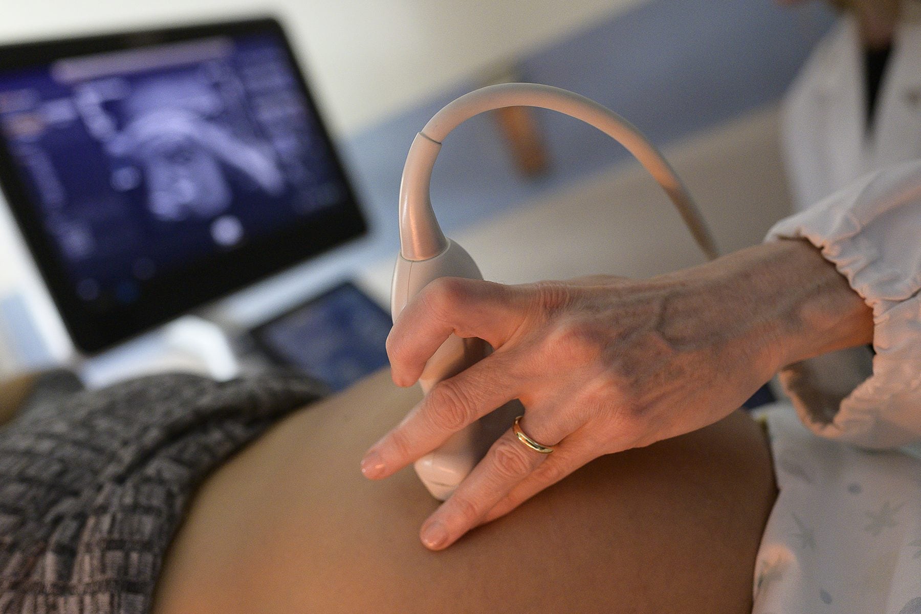 L’ecografia prenatale.