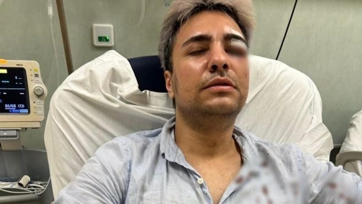 Il venticinquenne pestato a Roma durante l’aggressione omofoba.