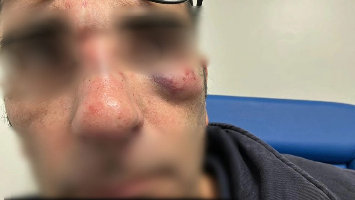 Il controllore Cotral aggredito sulla linea Fiuggi–Anagni. (Foto da Facebook)