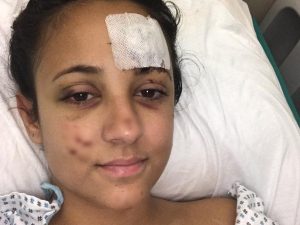 Falciata da un pirata della strada mentre attraversa col fidanzato: &#8220;Pensavano fossi morta, non sentivo più le gambe&#8221;