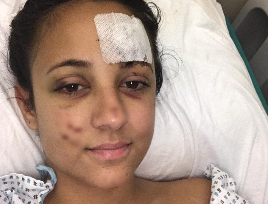 Caterina Pallocca subito dopo l’incidente a Monterotondo.