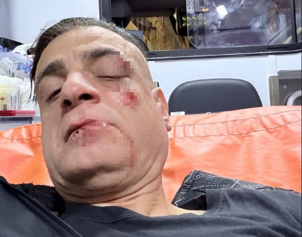 Dal profilo Instagram di Simone ’Cicalone’