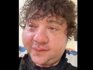 Il rapper Ozymandias picchiato dal branco a San Lorenzo: “Mi hanno spaccato di botte”