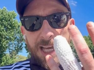 Giancane investito in via del Circo Massimo a Roma: “Sto bene ma è saltata una piccola falange del dito”