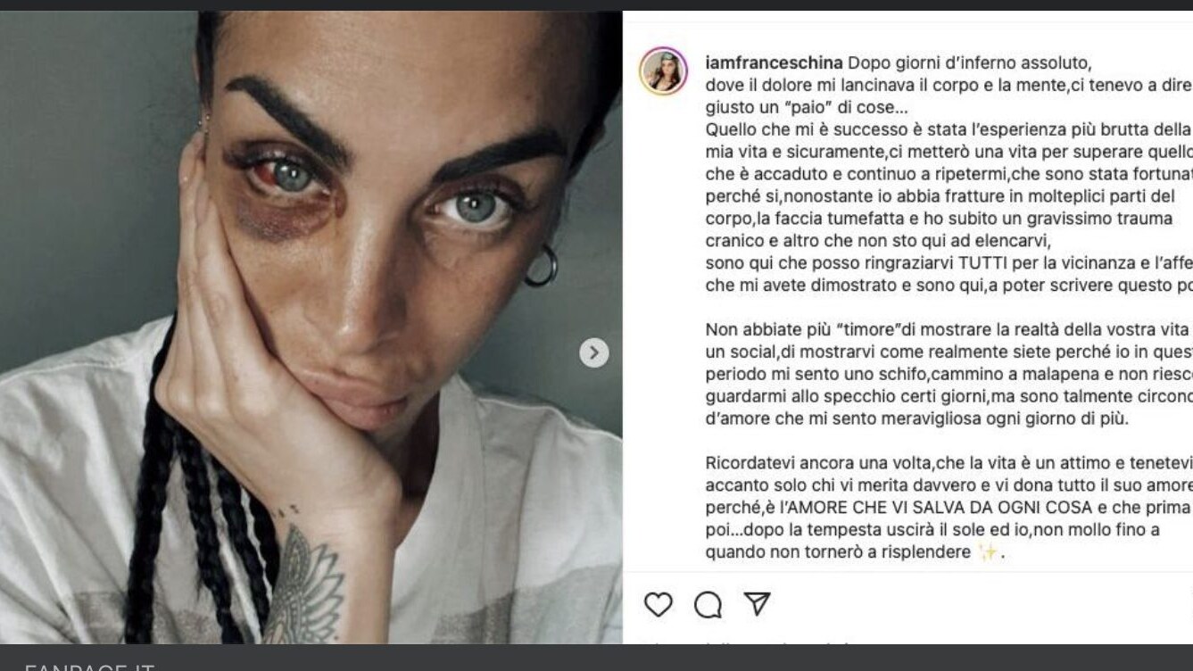 Immagine