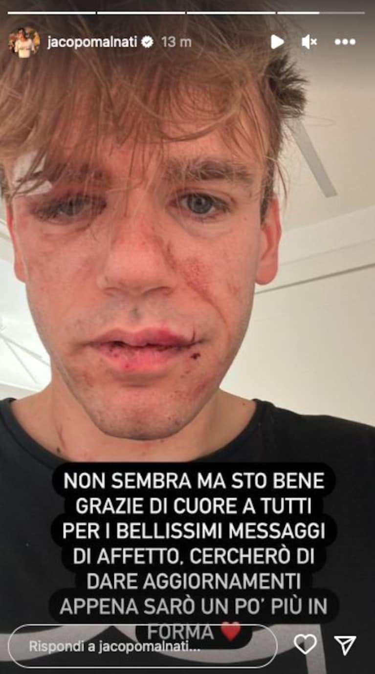 Immagine