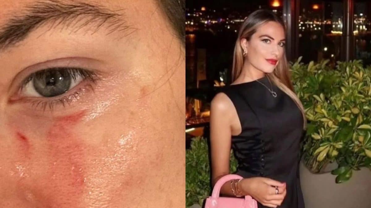 Pamela Genini, uccisa dal compagno Gianluca Soncin