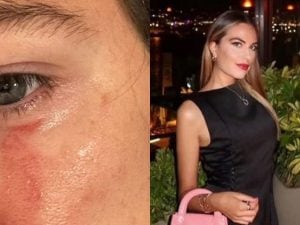 Femminicidio Pamela Genini a Milano, l&#8217;amica: &#8220;Mi mandò le foto dove aveva lividi sotto gli occhi&#8221;
