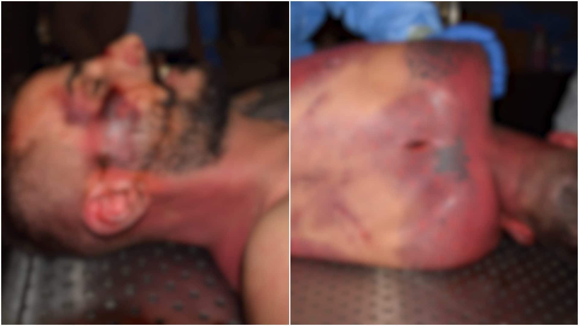 Le immagini autoptiche sono state diffuse dalla famiglia nella speranza di ottenere risposte dalla giustizia