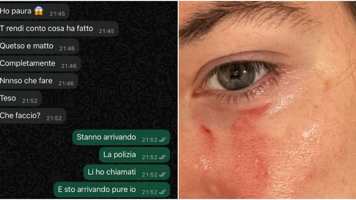 Gli ultimi messaggi inviati da Pamela Genini all’ex fidanzato e i segni delle violenze subite in passato da Gianluca Soncin