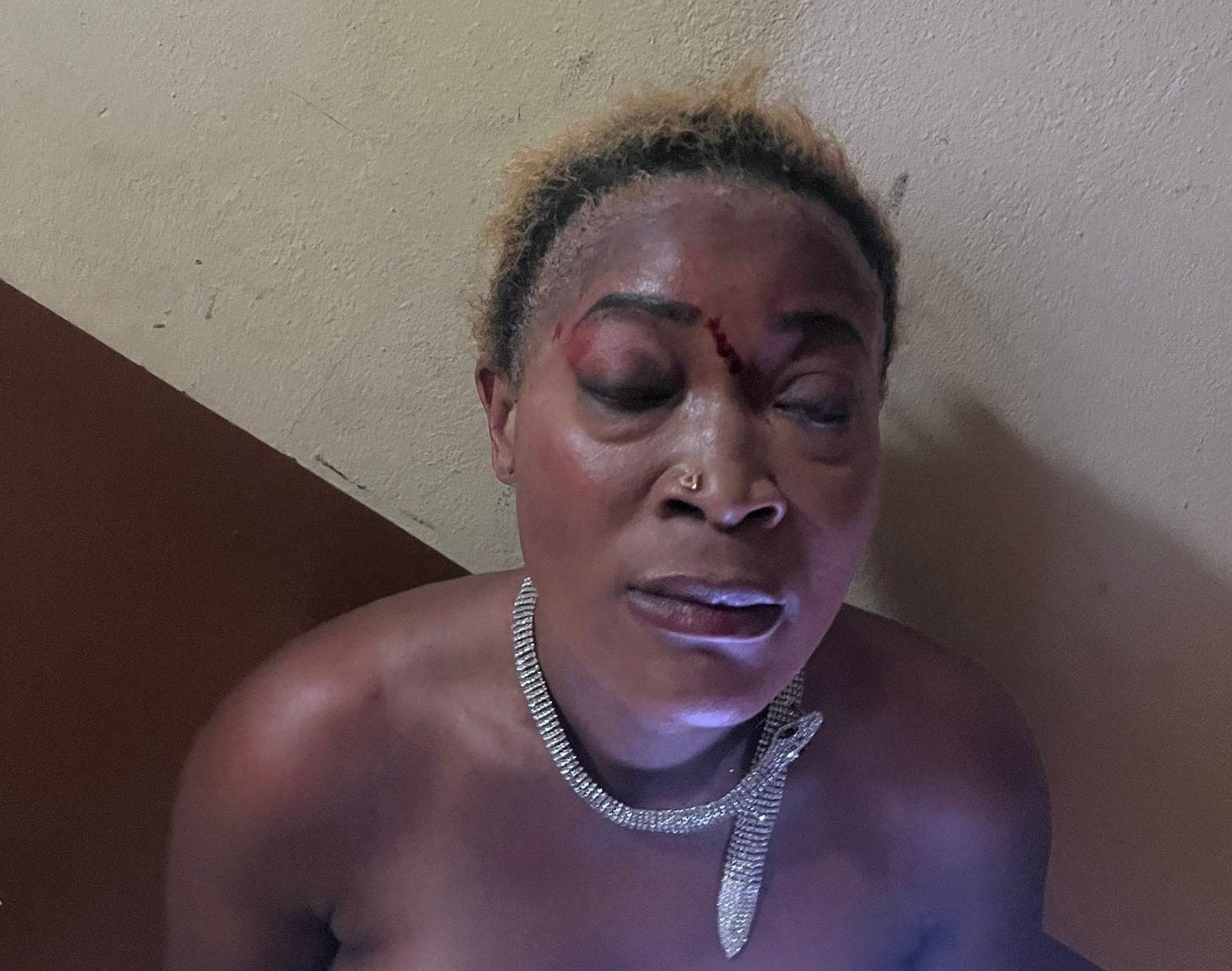 Reine Atadieu dopo l’aggressione di agosto 2025