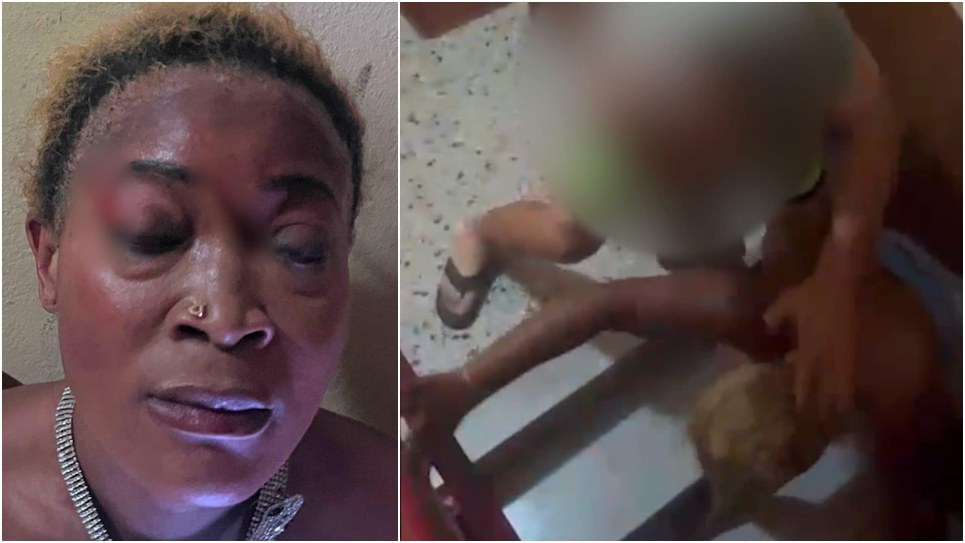 Reine Atadieu Djomkam, durante e subito dopo l’aggressione ad agosto 2025