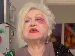 Wanna Marchi travolta da un’auto a Milano, il video dopo l’incidente: “La mia faccia è stravolta, sono devastata”