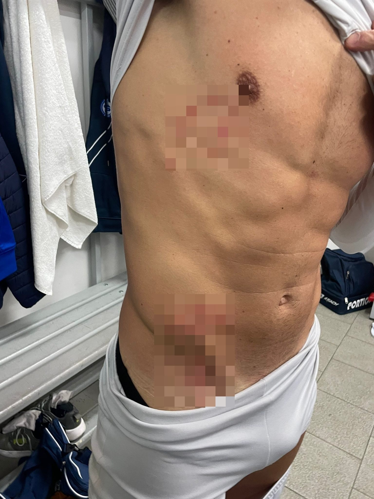 Calciatore del Portici picchiato nello spogliatoio dai tifosi dell'Angri: 