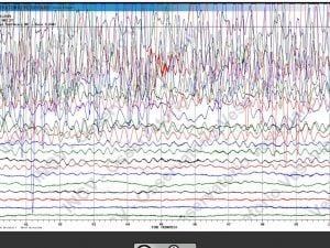 Il terremoto in Russia registrato dai sismografi dei Campi Flegrei: il tracciato all&#8217;1:24