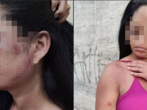 Aggredita a calci e pugni dall&#8217;ex-fidanzato 18enne della figlia: costretta a cambiare casa