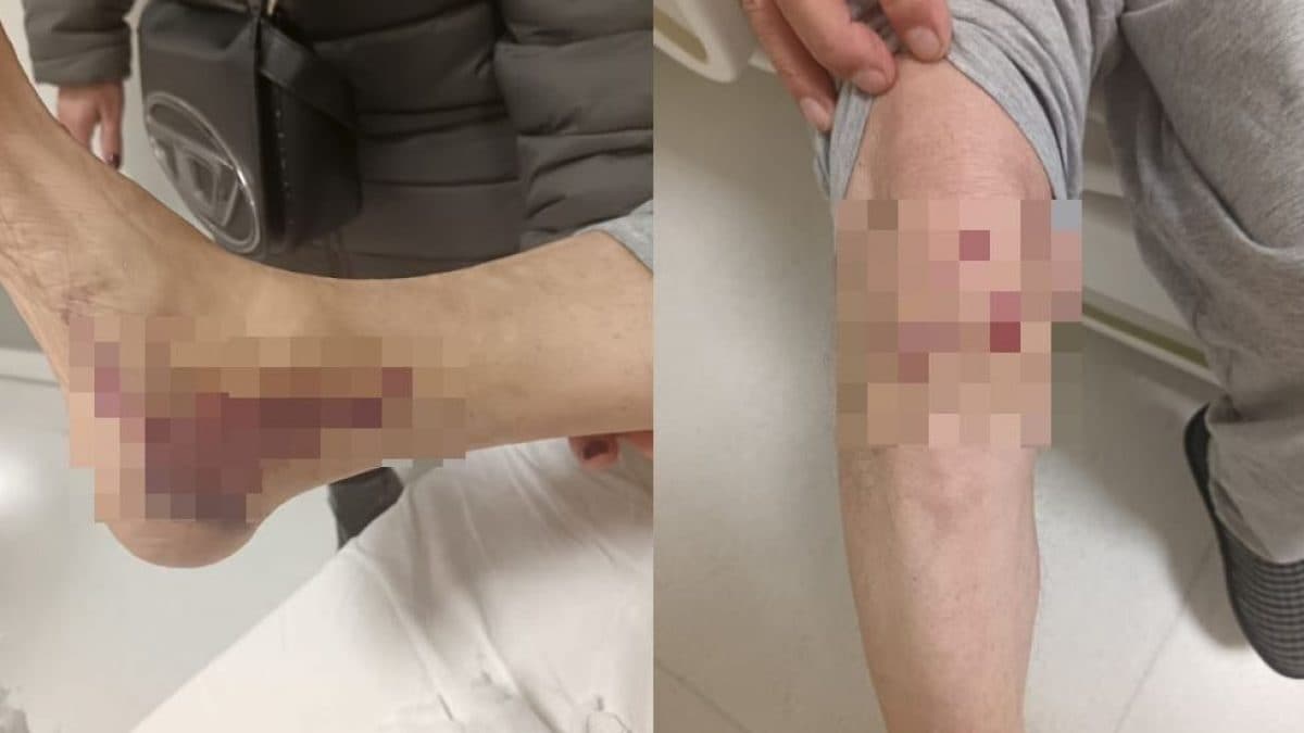 Le foto pubblicate dal parlamentare Francesco Emilio Borrelli (Avs)