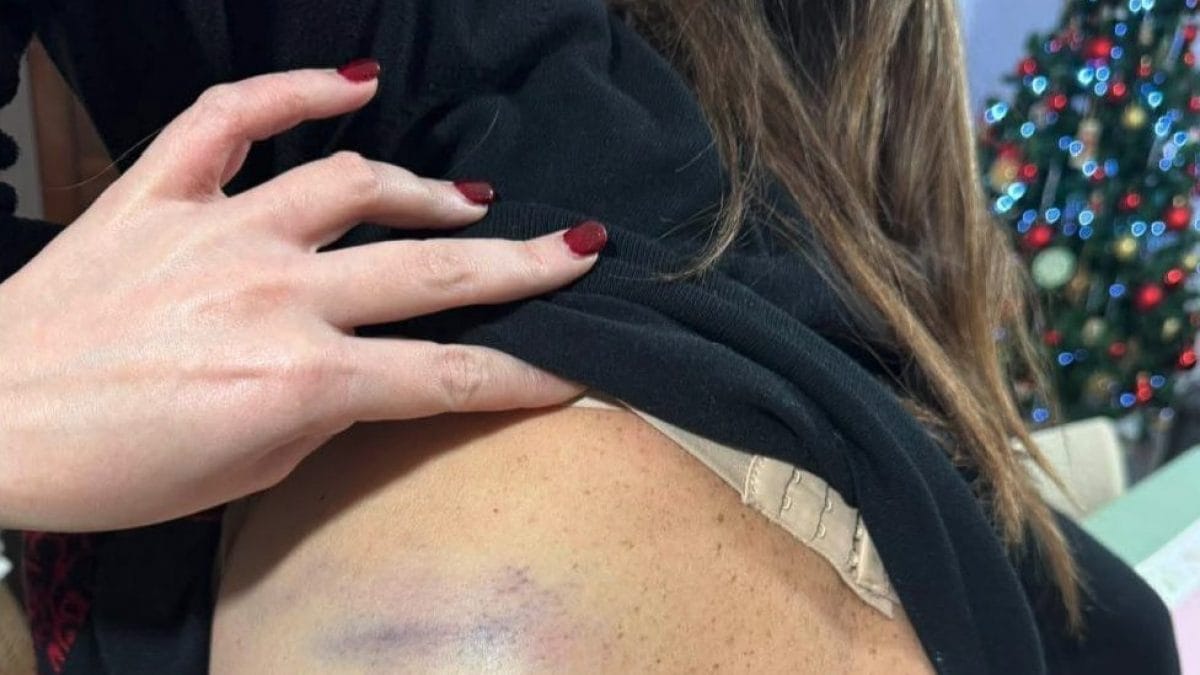 Una persona ferita durante la lite condominiale / Foto M5S Portici