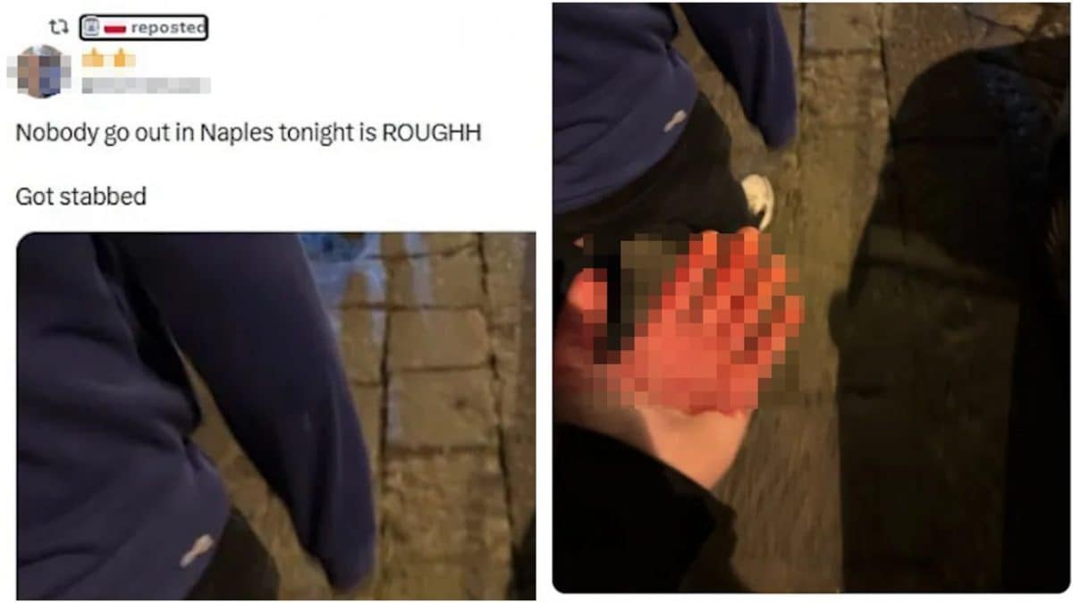 La foto del tifoso che mostra la mano insanguinata pubblicata sui social