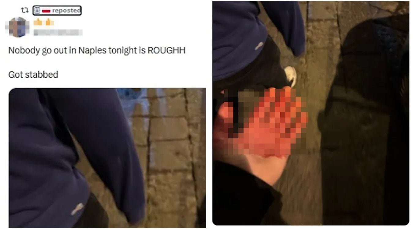 La foto del tifoso che mostra la mano insanguinata pubblicata sui social