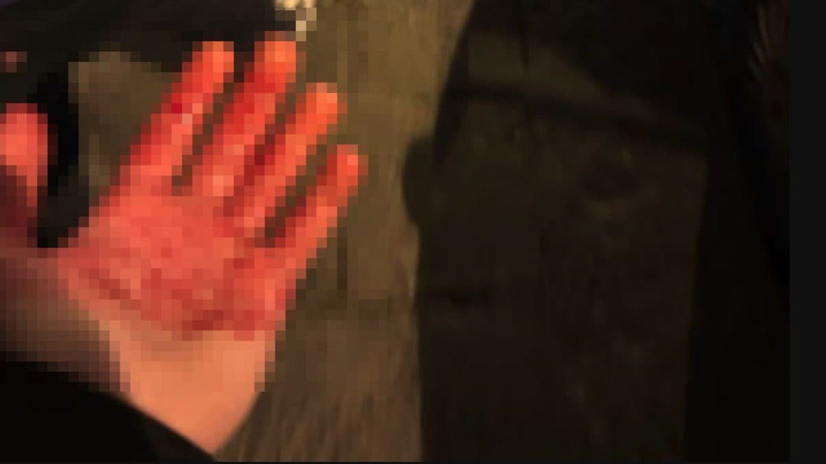 La fotografia pubblicata dal tifoso ferito sui social