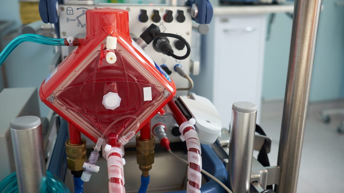 Il macchinario Ecmo, quello cui è attaccato il bimbo del Monaldi