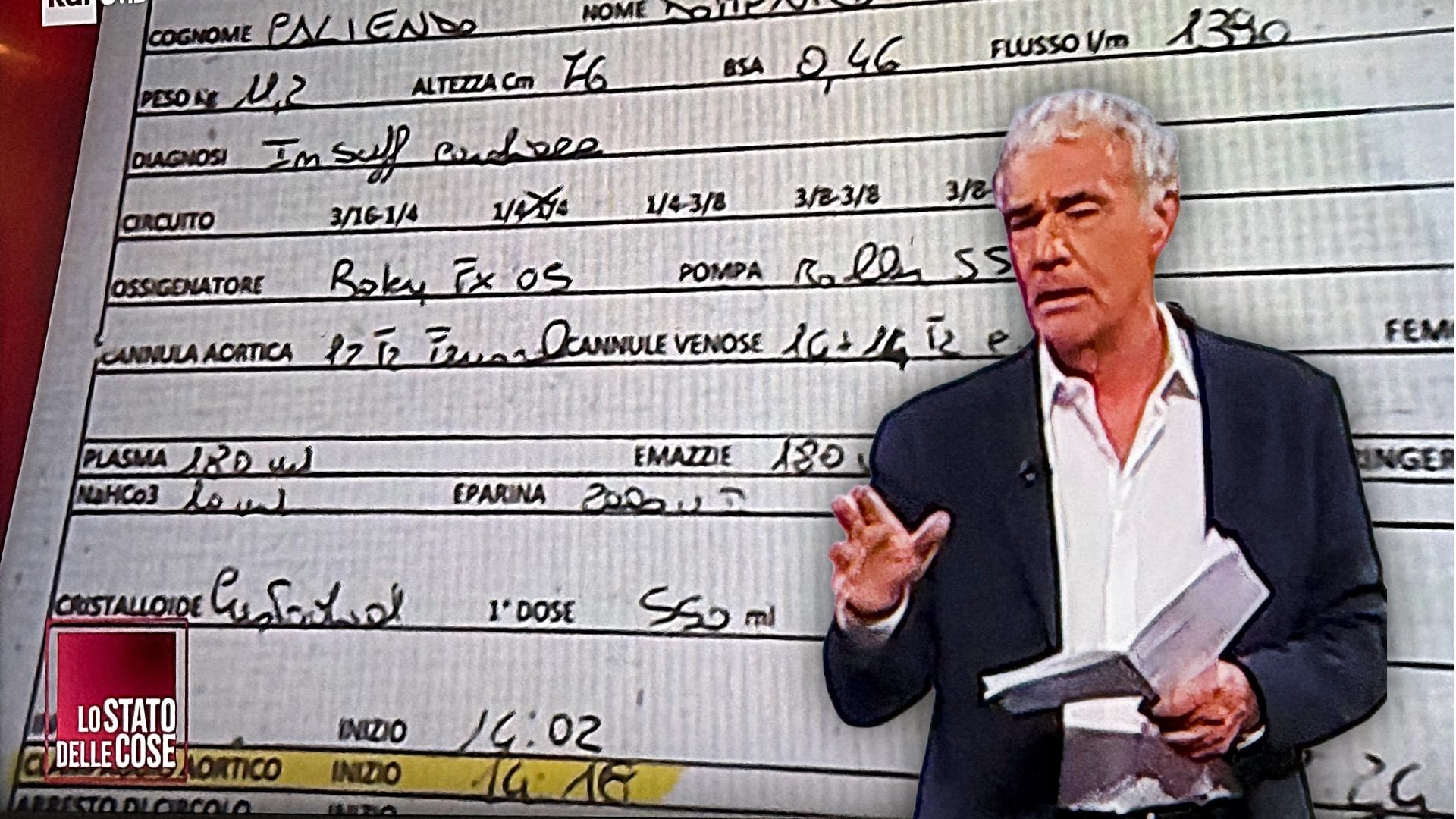 Morte di Domenico, l'espianto avviato 12 minuti prima dell'arrivo del nuovo cuore: l'orario delle cartelle cliniche