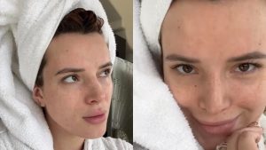 Bella Thorne senza trucco dopo il trattamento estetico