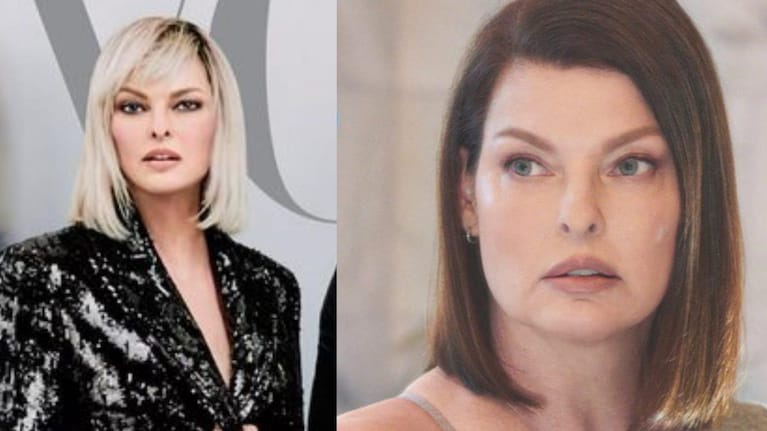 Un prima e dopo di Linda Evanvelista. A destra, il volto rovinato dalla chirurgia estetica.
