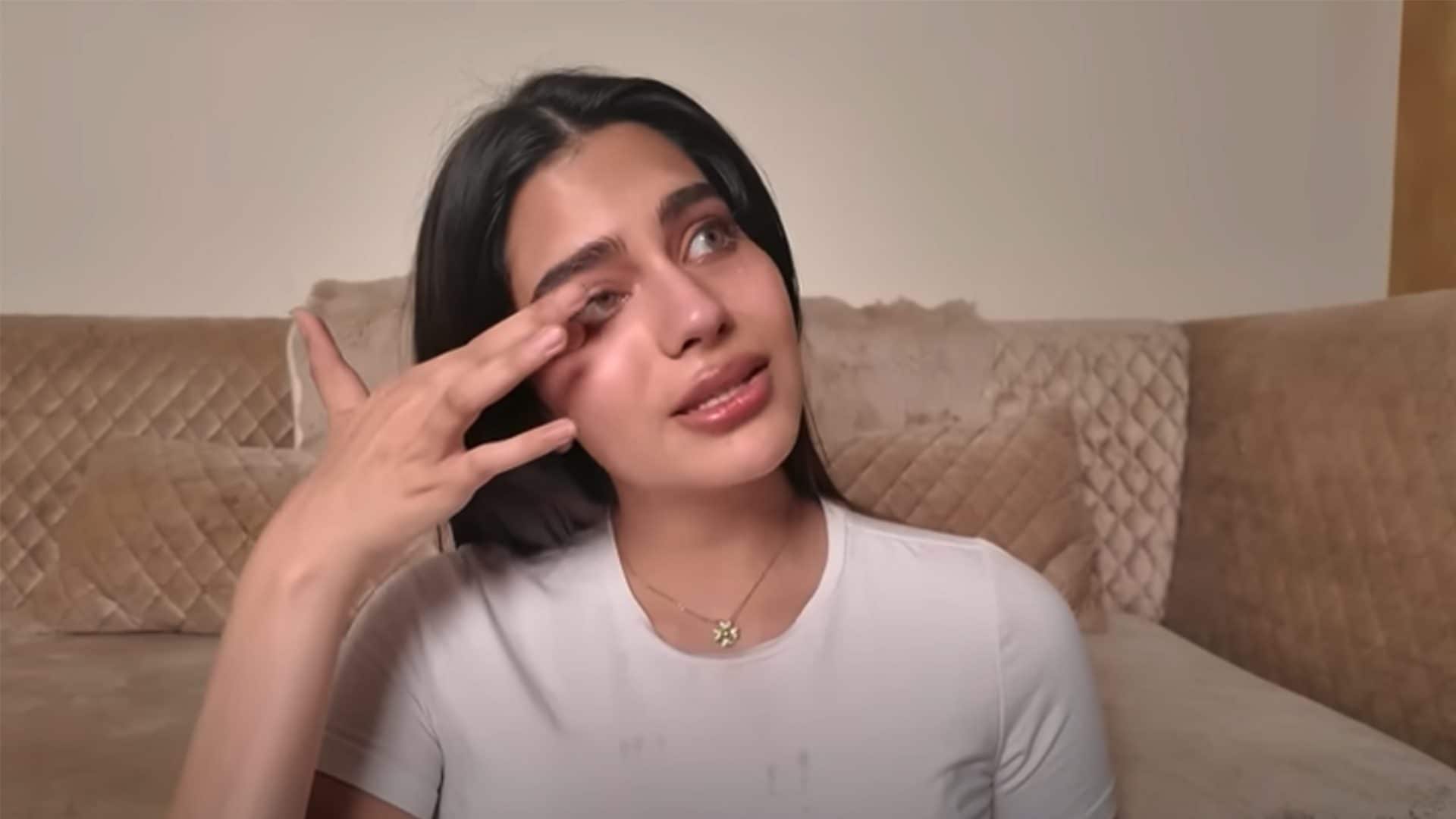 Reginetta di bellezza rinuncia al titolo e denuncia il concorso per maltrattamenti e body shaming