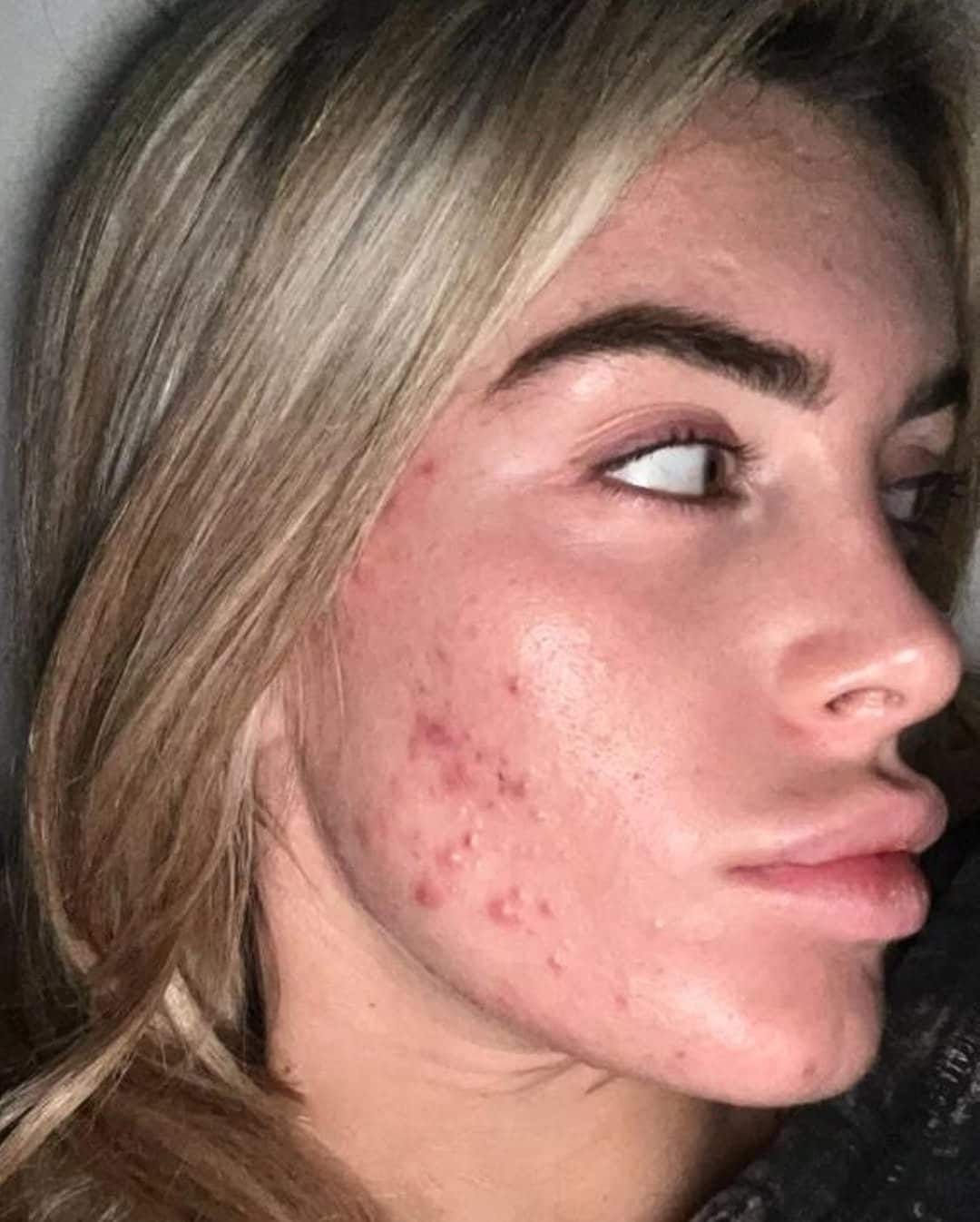 Instagram @inesmordentedermatologa