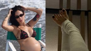 Perché Giulia De Lellis ha le gambe bendate
