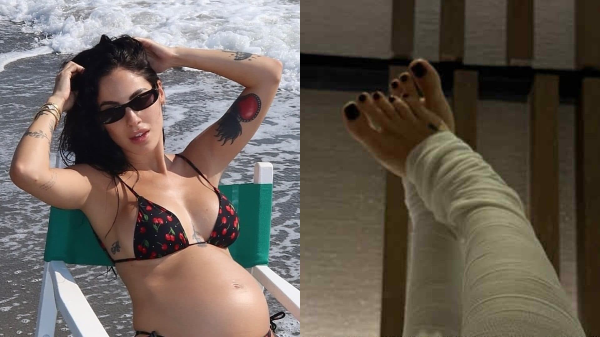 Perché Giulia De Lellis ha le gambe bendate: il trattamento da provare in gravidanza