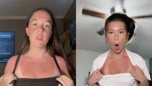 Scottarsi la pelle per fare like, la sfida su TikTok: "Danni seri, si rischiano tumori"