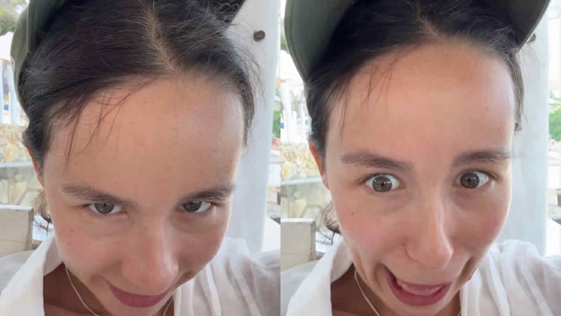 Aurora Ramazzotti contro gli stereotipi: in vacanza mostra la ricrescita dei capelli bianchi