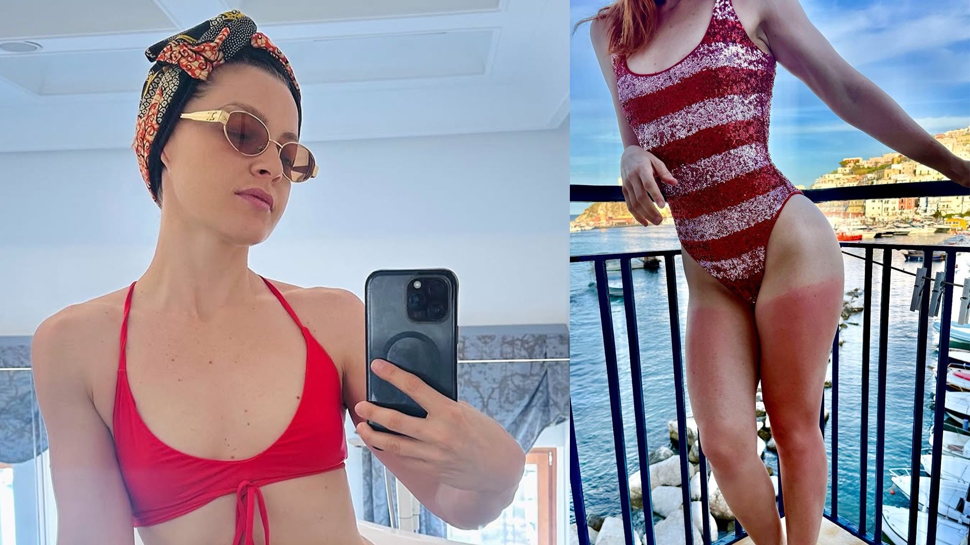 Noemi una di noi, ammette il fail con la scottatura: "Crema solare sempre anche sulle gambe"