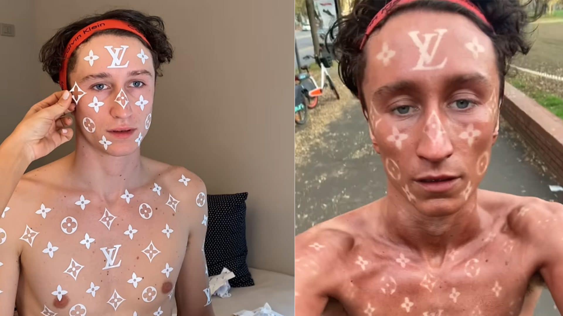 Un'abbronzatura di lusso: la sfida è lasciare loghi di Louis Vuitton in vista sulla pelle