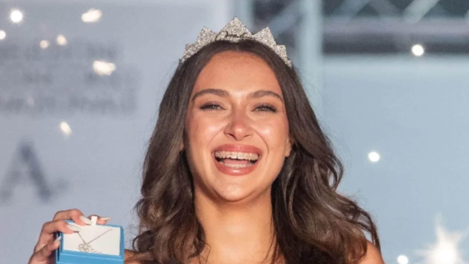 Katia Buchicchio, la prima Miss Italia con l'apparecchio ai denti è il simbolo della lotta ai tabù