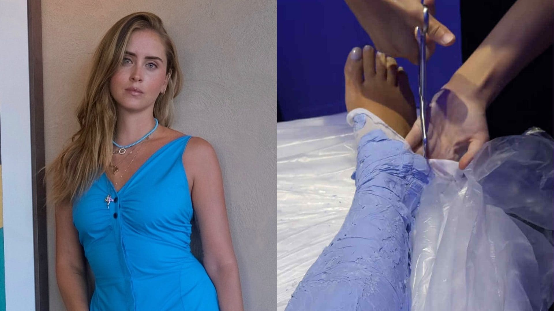 Perché Valentina Ferragni ha coperto le gambe con un calco di gesso