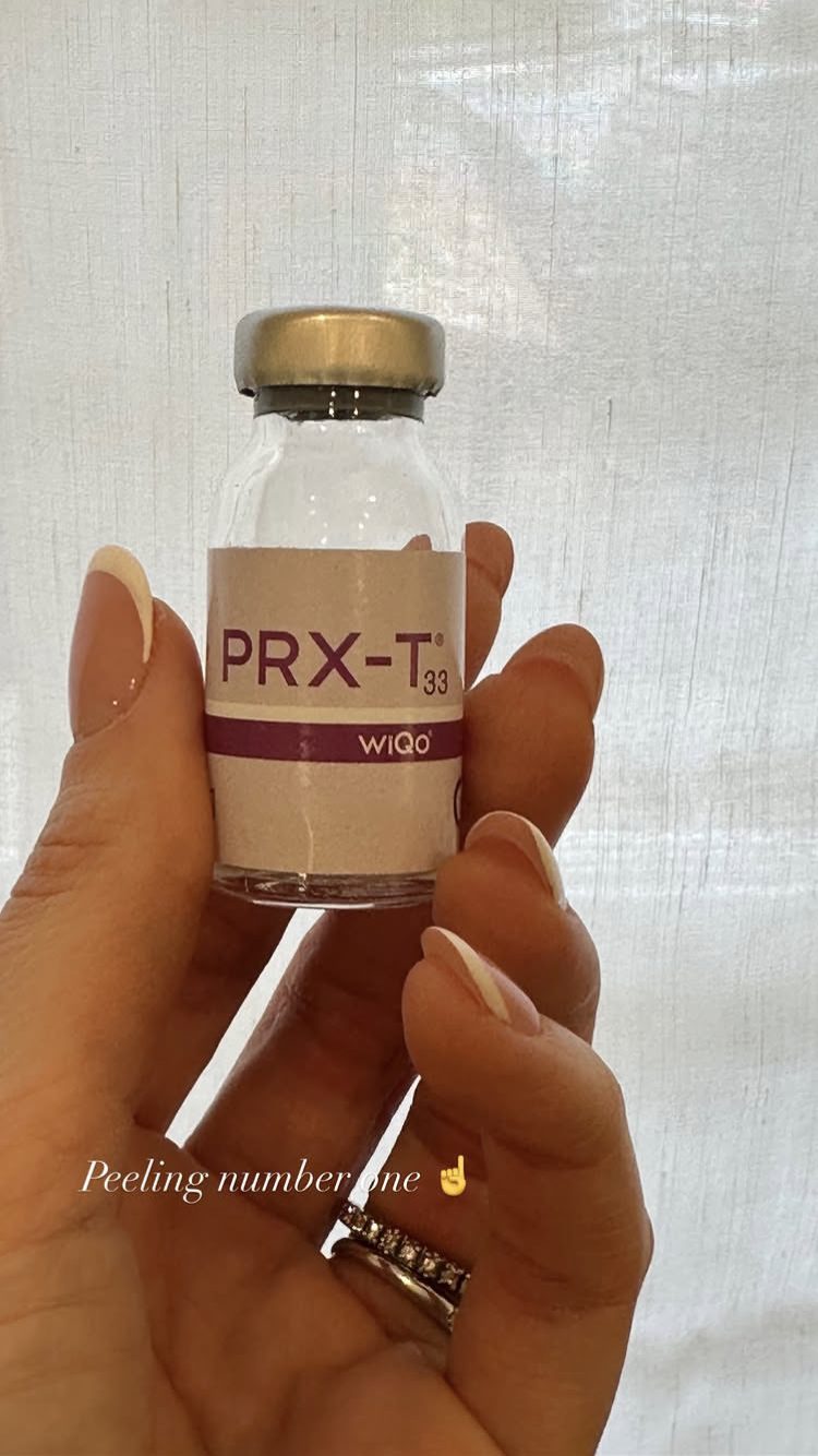 Il PRX–T33 di WiQo